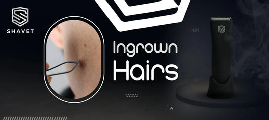 Tame the Bumps: Prevention Strategies for Ingrown Hairs